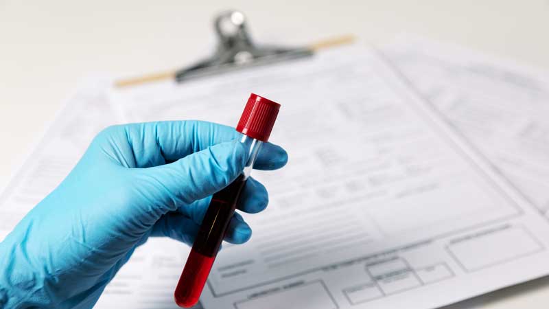 UK Briefing on 'Trublood®- Prostate' for Precision Non-invasive Prostate Cancer Diagnosis