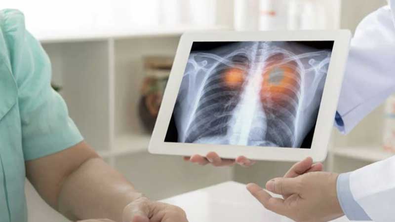 ONTARIO ⚕️ Ontario Connecting Long-Term Care Home Residents to More Diagnostic Services