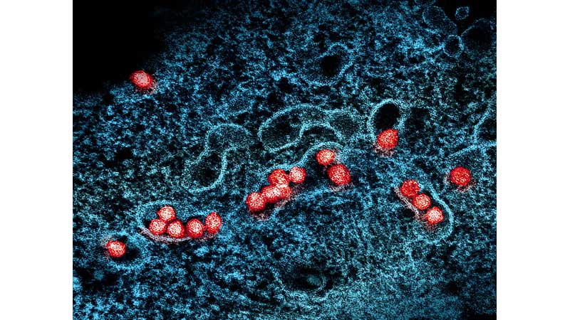 🍁🏙️⚠️⚕️ Toronto Public Health Reminds Residents to Take Precautions Against West Nile Virus This Summer 🦟