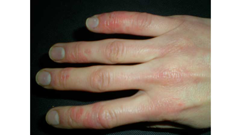 ONTARIO ⚕️💵 Ontario Increasing Access to Skin and Wound Care in Long-Term Care Homes